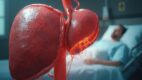 Acalculous Cholecystitis