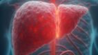 Acetaminophen Toxicity (Acetaminophen Poisoning)